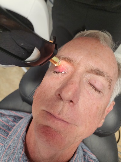 Photo of EnVision by InMode treatment being done